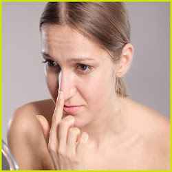 BLACKHEADS VIDEOS 2017